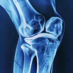 X-Ray Bones Knee Joint Wide
