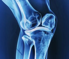 X-Ray Bones Knee Joint Wide