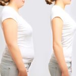 Young Woman Obesity Weight Loss Before and After