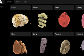 Explore the human body in stunning, 3D detail with a new online tool