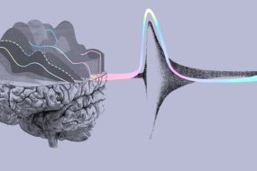 CollectivIQ, Artistic images of the brain and action potentials happening in it.